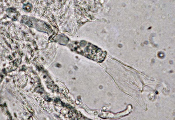 Weißlicher Keulengallertpilz-Tremellodendropsis tuberosa
